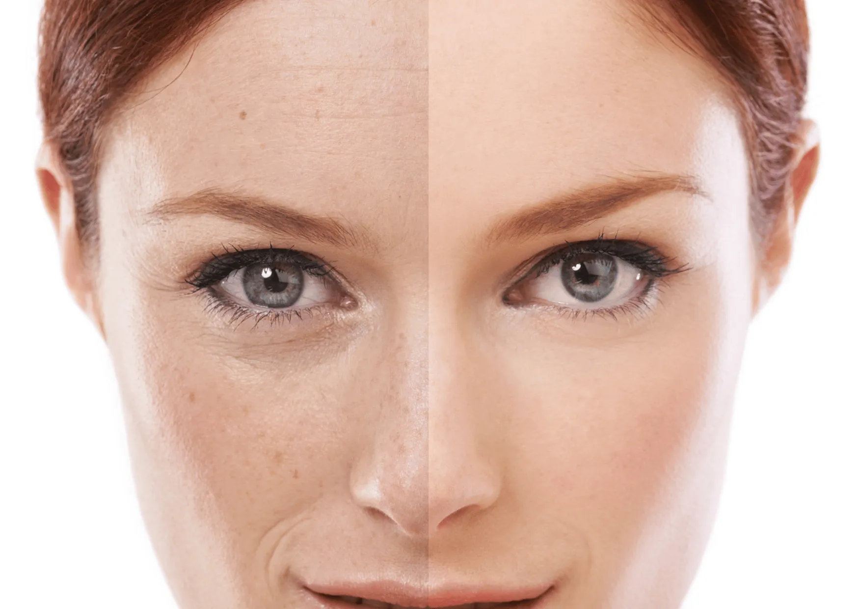 Skin Pigmentation section 3