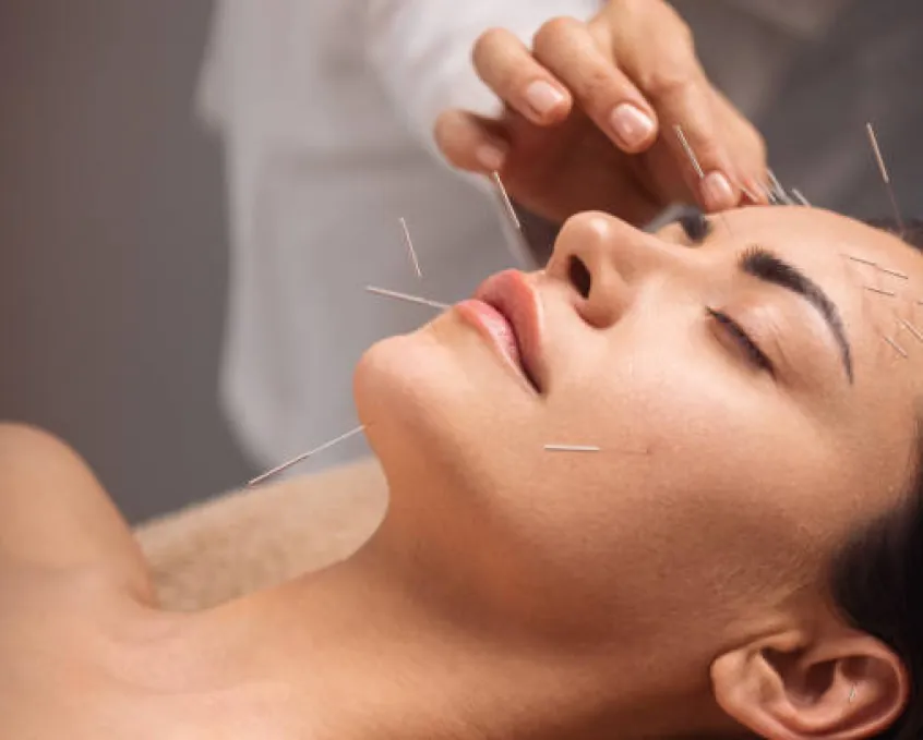 Acupuncture section 2
